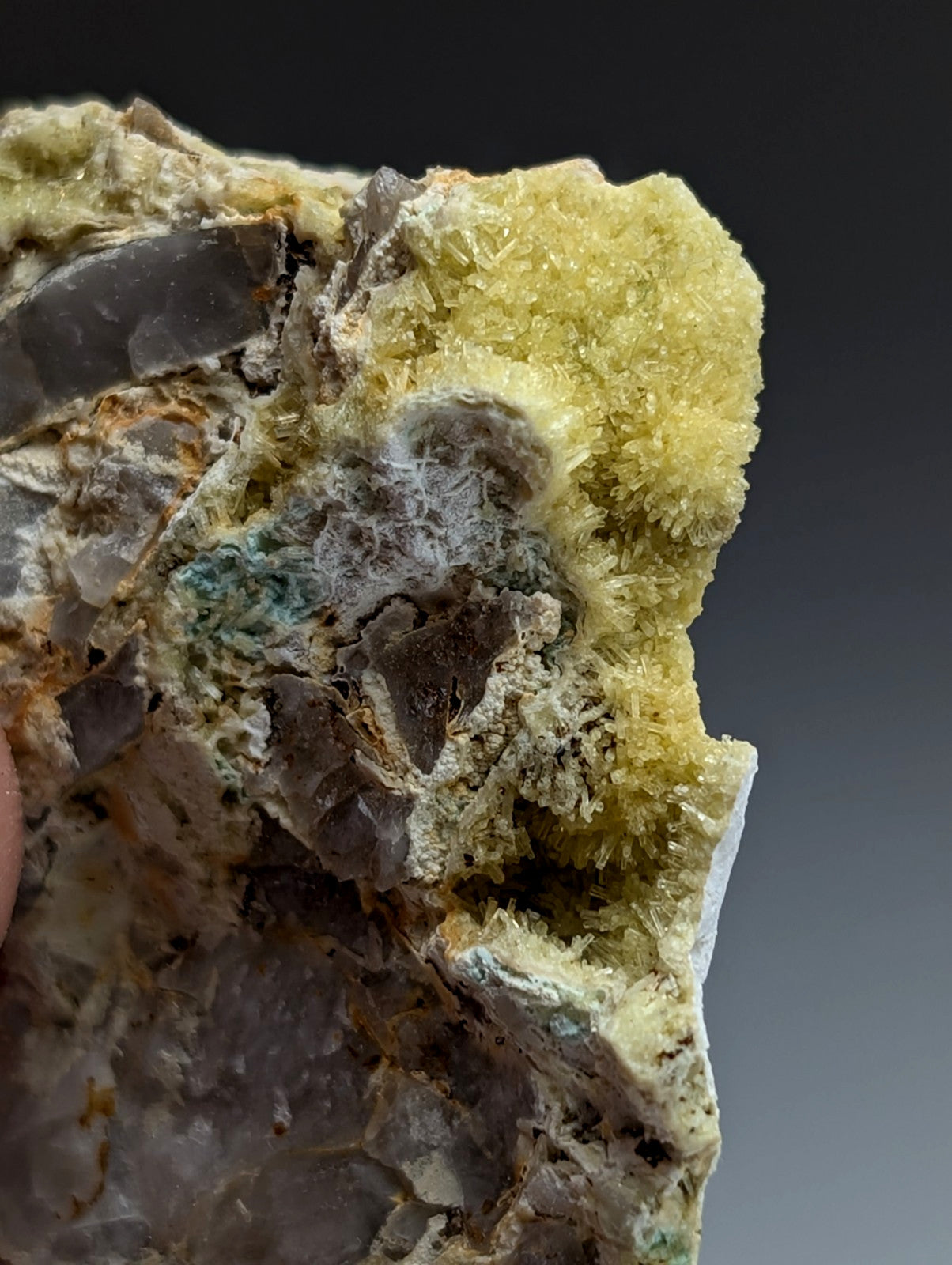 Wavellite with Variscite - Rare Old Stock - Polk County, Arkansas, Super Unique