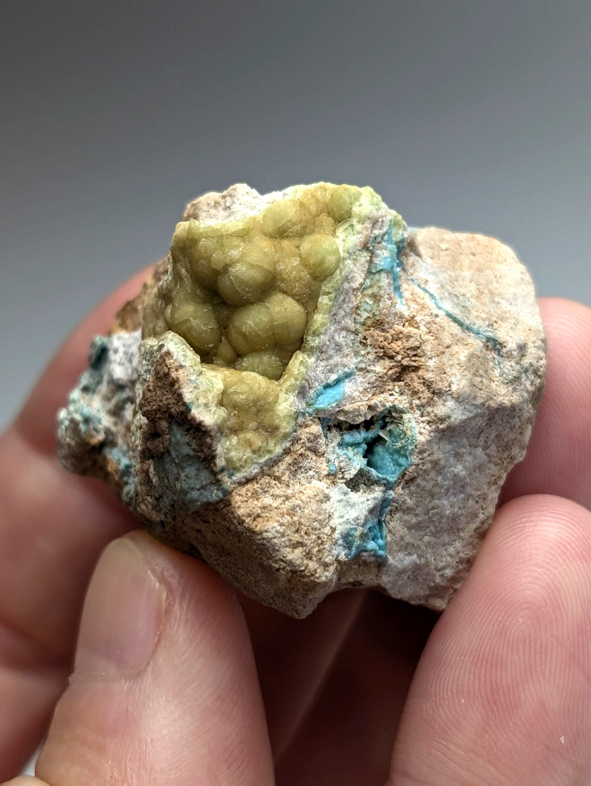 A hand holds unique wavellite with near-turquoise veins and yellowish-green nodules from Garland County Arkansas